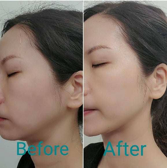 【緊緻水嫩】600秒藍寶石HIFU面膜